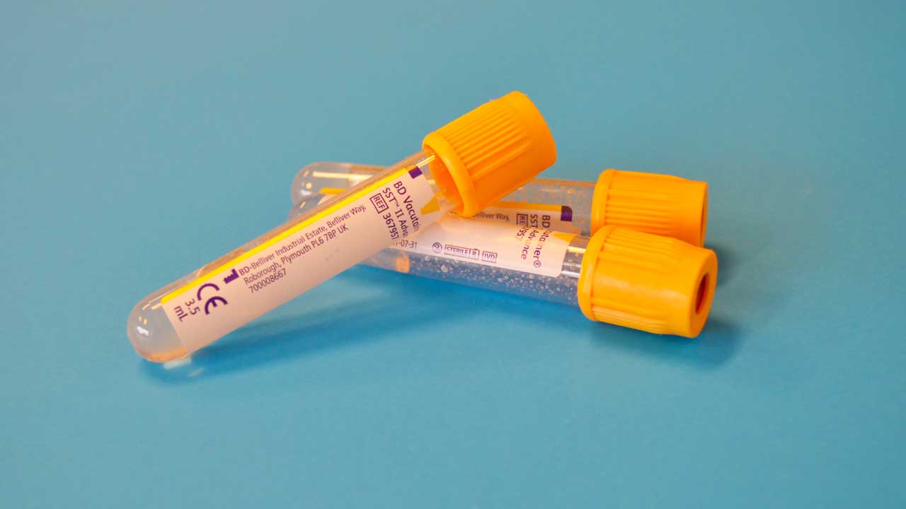 a CBD blood test on blue background